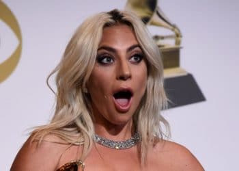 Lady Gaga antes de someterse a cirugías plásticas