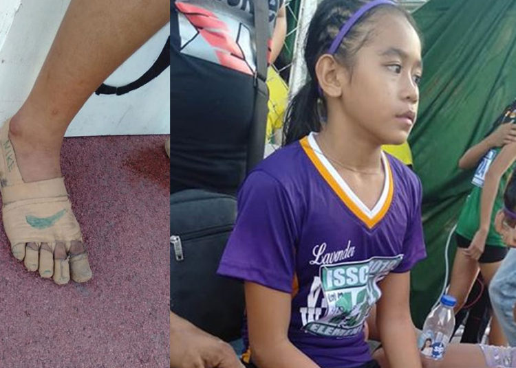 Niña corre con vendas en los pies y gana tres competencias