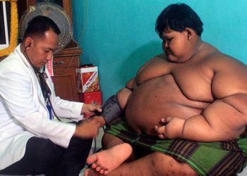 El ‘niño más gordo del mundo’ logró bajar más de 100 kilos