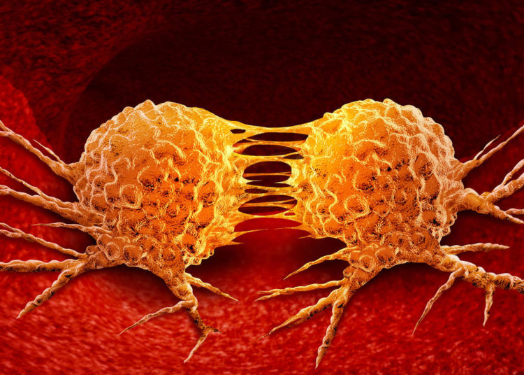 Científicos descubrieron la causa de la metástasis y se abre una vía para posible tratamiento del cáncer