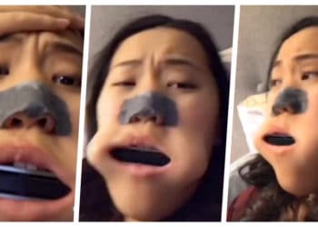 (VIDEO) Una mujer se mete una armónica en la boca y tuvo que ir de emergencia al médico