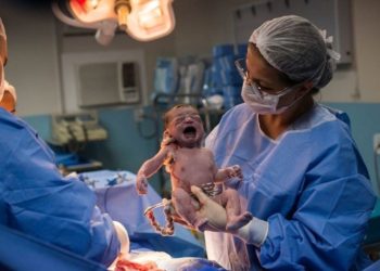 Una recién nacida mira al médico con cara de pocos amigos