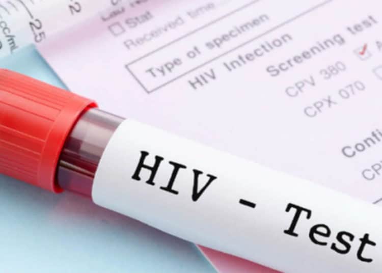 El venezolano Adam Castillejo, segundo paciente curado de VIH en el mundo