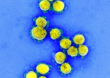 Captan en fotografía al coronavirus atacando células humanas