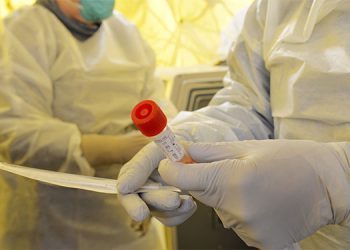 Anuncian el éxito de las primeras pruebas de la vacuna contra el coronavirus en Francia