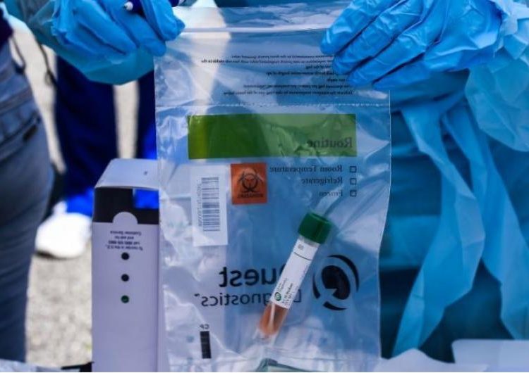 Un hombre contrae doble infección de coronavirus detectada hasta el momento