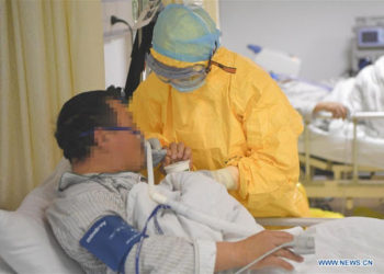 El extraño cambio en el color de la piel de dos médicos que sobrevivieron al coronavirus en Wuhan