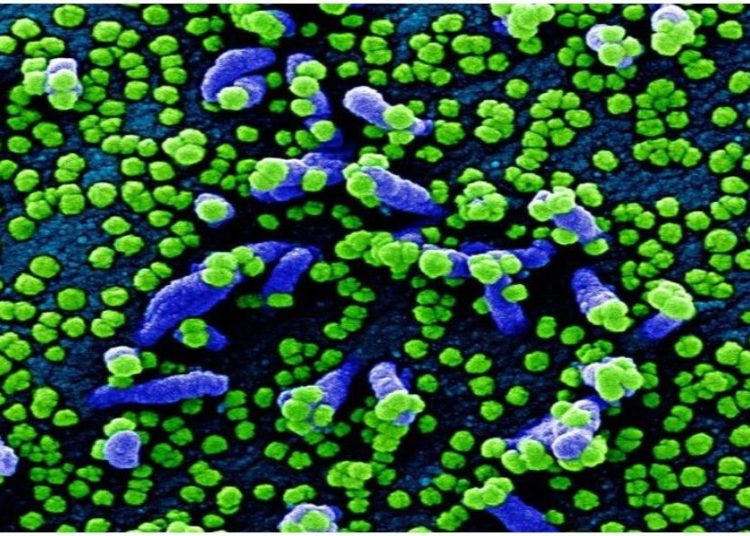 Explican cómo el coronavirus se camufla cual «lobo con piel de cordero» para engañar a nuestro organismo