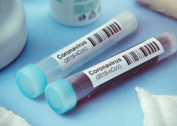 Registran 85 nuevos casos de covid-19; «Estamos en la etapa de mayor riesgo de contagio», afirma Bukele