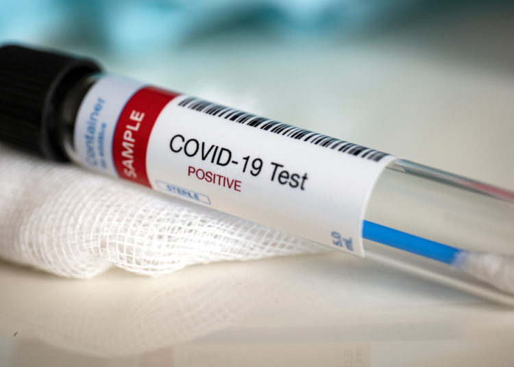 El Salvador experimentó un repunte de casos de covid-19 este miércoles: 75 nuevos contagios