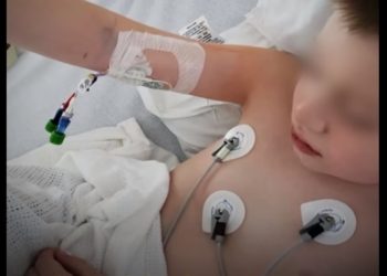 Raro síndrome ligado al covid-19 puede provocar mortal ‘tormenta de citoquinas’ en niños