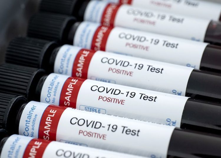 Cifra de contagios de covid-19 sube a 446; viernes se detectaron 22 nuevos casos en El Salvador