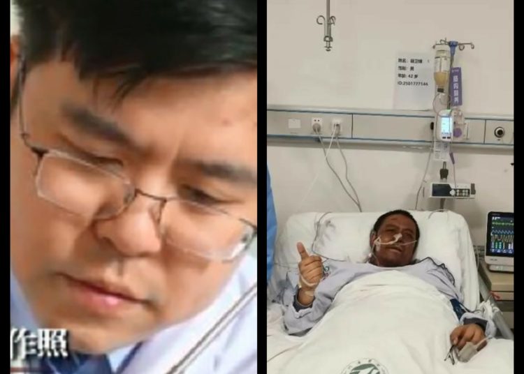 Fallece uno de los médicos chinos cuya piel se oscureció tras superar el covid-19