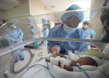 En Perú un bebé prematuro extremo de solo 580 gramos supera al coronavirus