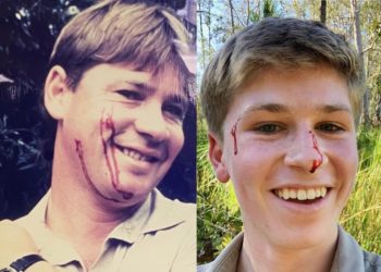 (VIDEO) El hijo del ‘Cazador de cocodrilos’ es mordido en la cara por una pitón