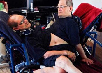 Los hermanos siameses más longevos del mundo mueren a los 68 años