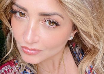 Andrea Legarreta, con la piel dañada tras padecer Covid-19 recurre a intensivo tratamiento