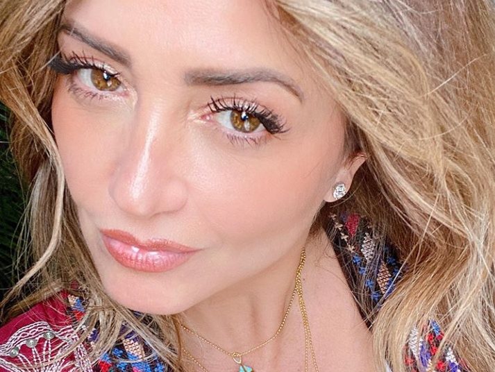 Andrea Legarreta, con la piel dañada tras padecer Covid-19 recurre a intensivo tratamiento