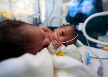 Científicos identifican a dos mellizos de padres diferentes en Colombia