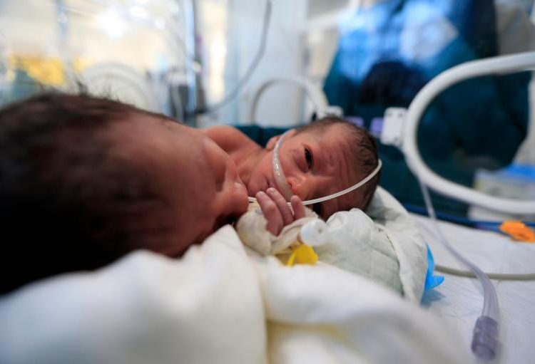 Científicos identifican a dos mellizos de padres diferentes en Colombia