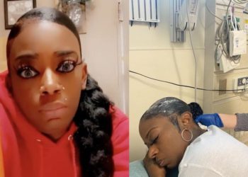 (VIDEO) Tras una operación de 4 horas logran retirar el pegamento Gorilla Glue del cabello de la mujer que lo usó en lugar de laca