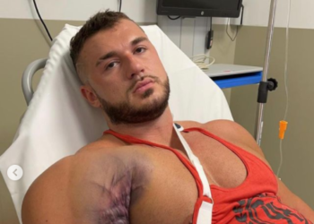 (VIDEO) Un fisiculturista sufre una grave lesión al tratar de levantar demasiado peso