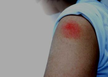 Cuáles son los efectos secundarios que puede causar la vacuna del covid-19 según tu edad, sexo y dosis