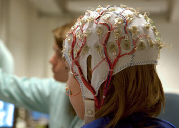 Una persona con parálisis logra escribir «gracias» por medio de un implante cerebral