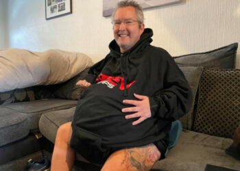 Un hombre con los riñones gigantes será operado para evitar una muerte segura