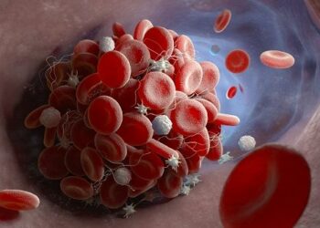 Descubren por qué algunos pacientes con Covid-19 desarrollan coágulos de sangre que ponen en peligro su vida