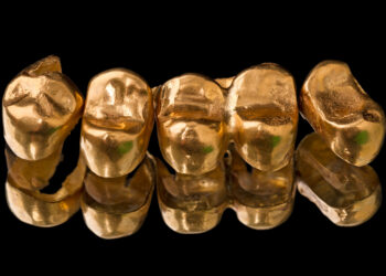 Detienen a dos hombres en la India que intentaban contrabandear casi un kilo de oro en forma de sus prótesis dentales