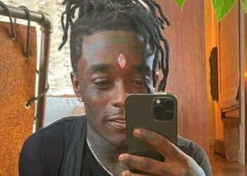 Seguidores del rapero Lil Uzi Vert le arrancan el diamante rosado de 24 millones de dólares que se implantó en la frente