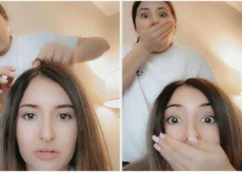 Alertan que el reto viral en TikTok ‘estallido del cuero cabelludo’ puede causar serios daños a la salud