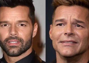 La verdad detrás de los supuestos arreglos estéticos en el rostro de Ricky Martin
