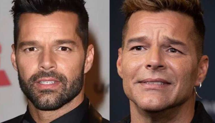 La verdad detrás de los supuestos arreglos estéticos en el rostro de Ricky Martin