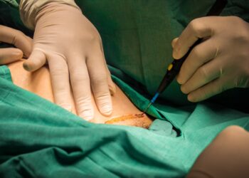 Hospital de San Bartolo recibe moderno equipo de cirugía