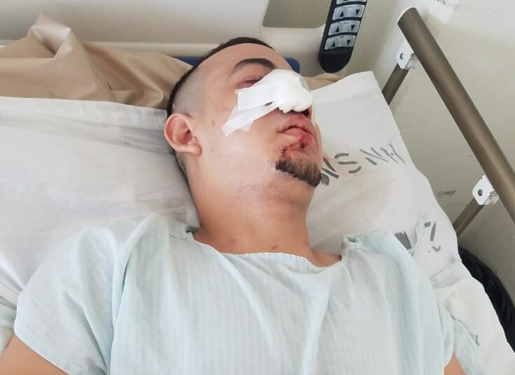 PNC reporta la captura de un pandillero de la MS-13 en un hospital