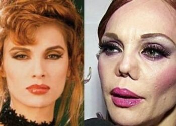 Carmen Campuzano, la supermodelo que se desfiguró la nariz por un accidente y las drogas