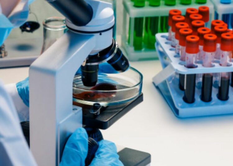 Descubren nueva variante más virulenta y transmisible del VIH