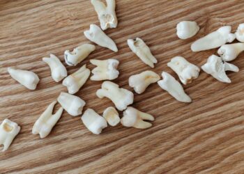 Cientos de dientes humanos caen sobre un hombre durante las reparaciones de una tienda en EE.UU.