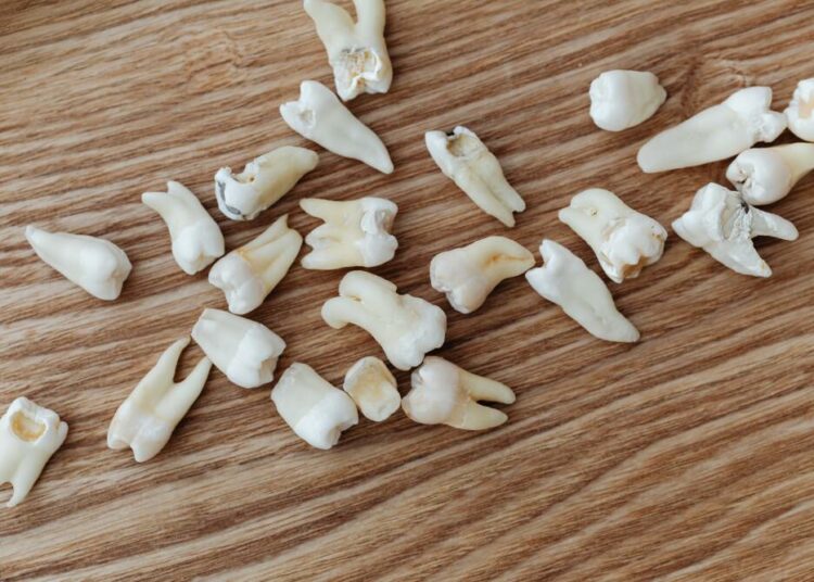 Cientos de dientes humanos caen sobre un hombre durante las reparaciones de una tienda en EE.UU.