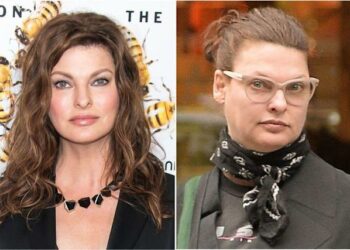 El calvario de Linda Evangelista tras quedar desfigurada por un retoque estético: “No me miro al espejo, ya no soy yo”