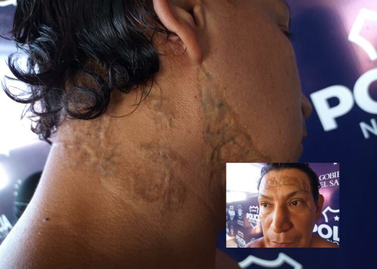 Capturan a pandillero que trató de ocultar sus tatuajes con quemaduras