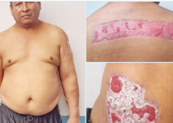 «El Varón» intentó borrarse los tatuajes, pero fue detenido por la policía