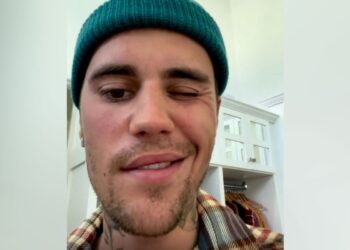 Qué es el síndrome de Ramsay Hunt, el padecimiento de Justin Bieber