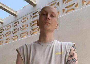 Murió Charlie, el famoso tiktoker español que contaba cómo era vivir con cáncer