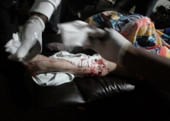 Perro ataca salvajemente a su dueña, en Santiago de María