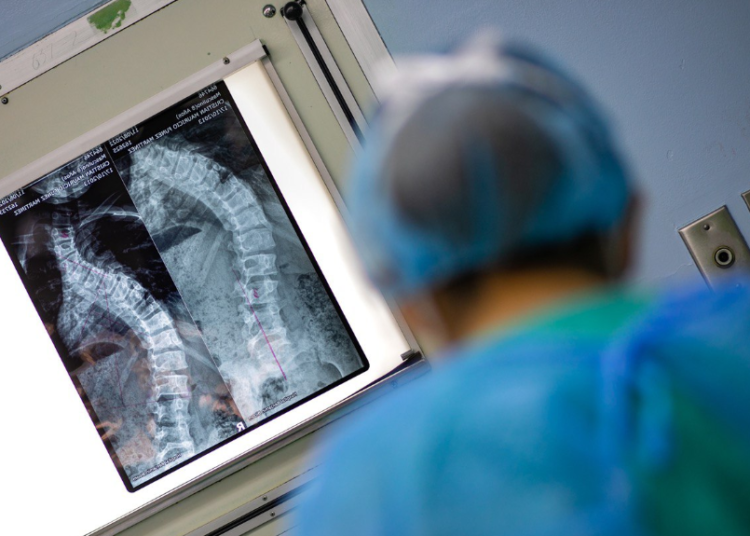 Ministerio de Salud realiza jornada de ortopedia pediátrica en el Hospital Bloom