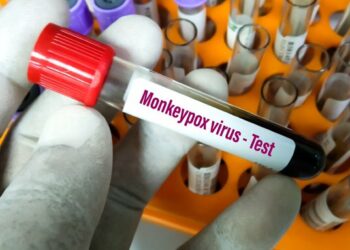 EEUU declaró la emergencia sanitaria por el aumento de casos de viruela del mono