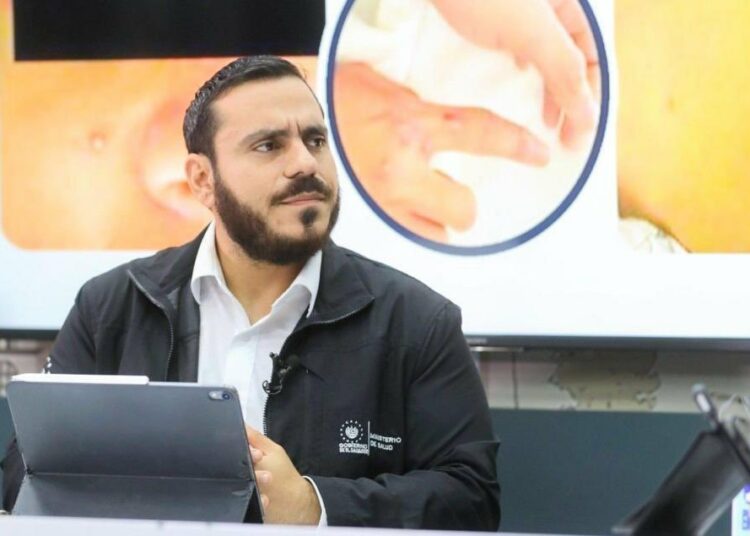 Ministro de Salud descarta posibilidad de cuarentena por viruela símica en el país
